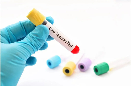 Why Do I Need a Repeat Liver Function Test? Key Reasons Explained - The National Blood Test Clinic