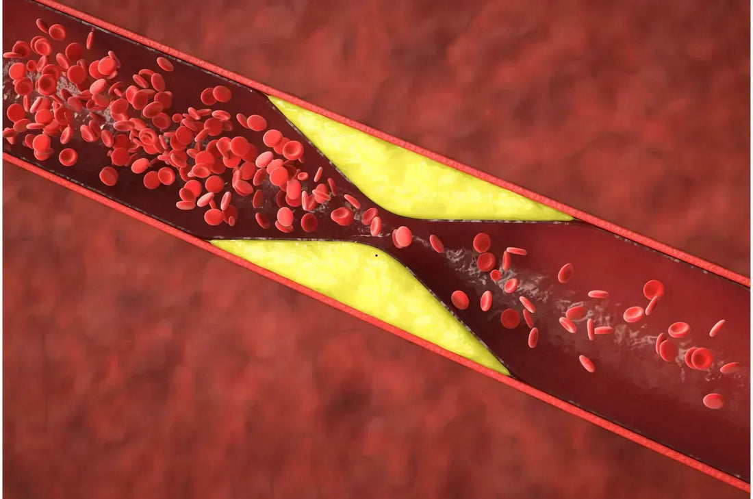 Can High Cholesterol Cause Fatigue? Is There Any Link? - The National Blood Test Clinic