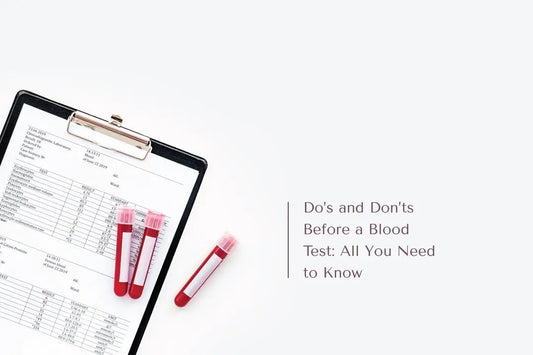 Do’s and Don’ts Before a Blood Test: All You Need to Know - The National Blood Test Clinic