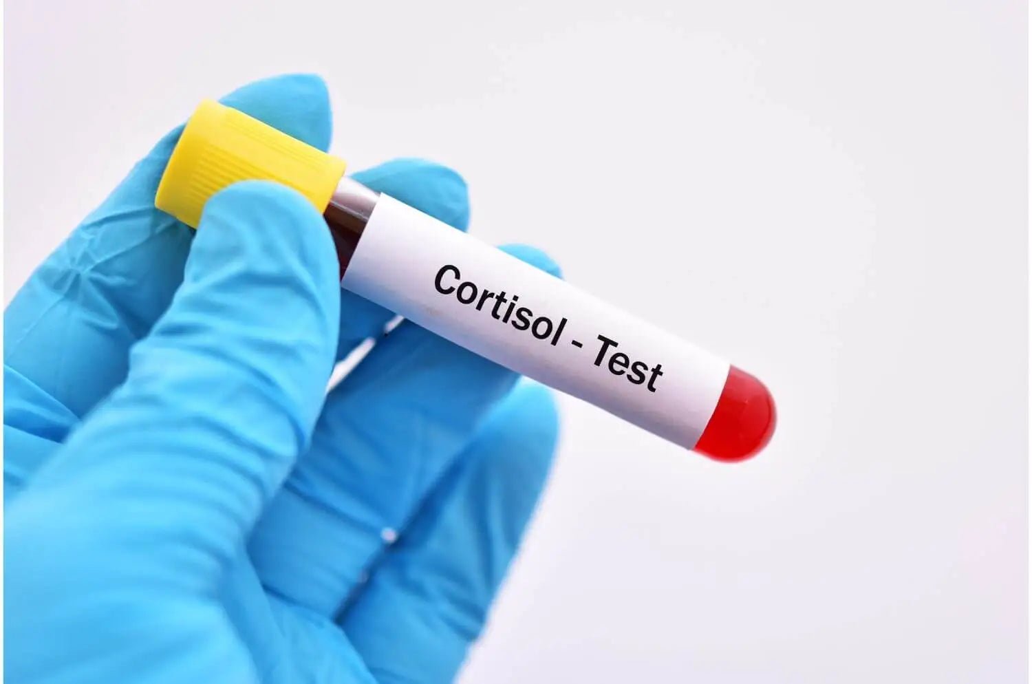 How to Test Cortisol Levels at Home UK? Fast & Reliable Way – The ...
