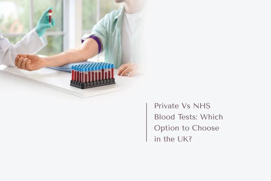 Private Vs NHS Blood Tests: Which Option to Choose in the UK? - The National Blood Test Clinic