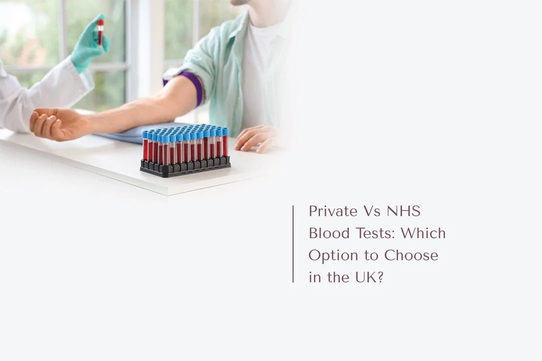 Private Vs NHS Blood Tests: Which Option to Choose in the UK? - The National Blood Test Clinic