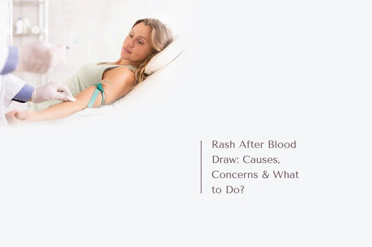 Rash After Blood Draw: Causes, Concerns & What to Do? - The National Blood Test Clinic