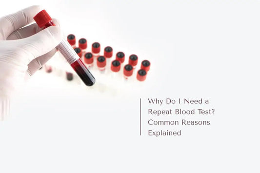 Why Do I Need a Repeat Blood Test? Common Reasons Explained - The National Blood Test Clinic