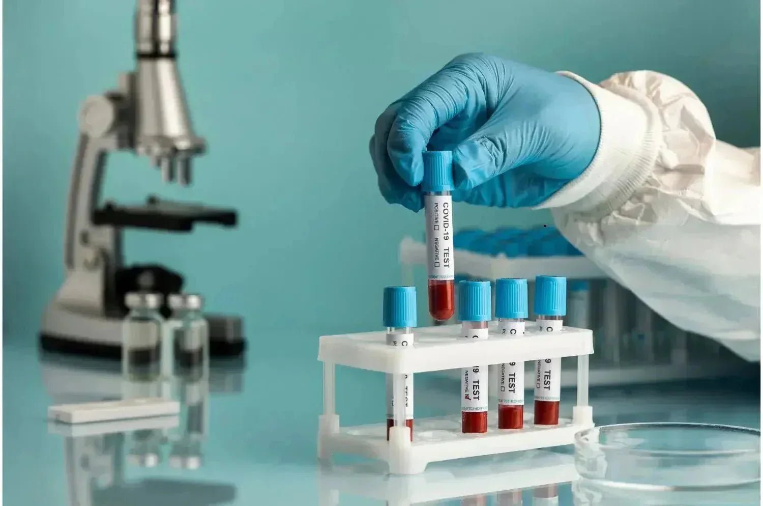 Why Do I Need a Repeat Blood Test? Common Reasons Explained – The ...