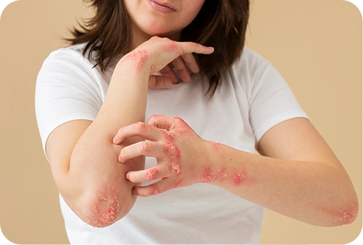 Allergy Blood Test for Immune Health